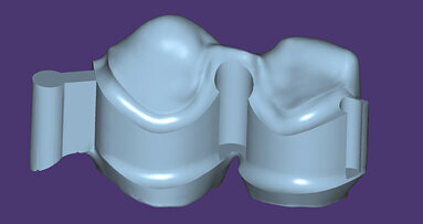 exocad DentalCAD: la nuova generazione