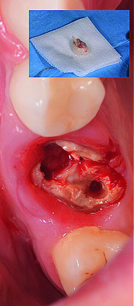 Fig. 4a