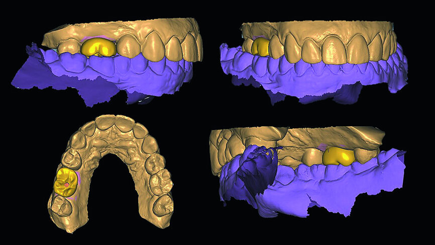 Fig. 12