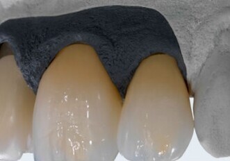 Ossido di zirconio Ceramill Zolid FX
