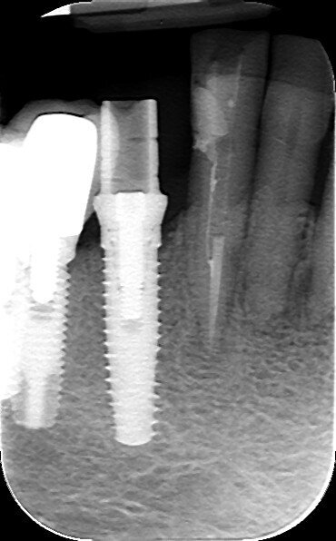 Fig. 11