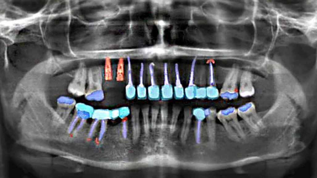 A análise de radiografias baseada em inteligência artificial economiza tempo no atendimento