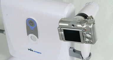 World Health Organization honors oral cancer screening device