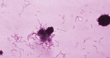 Científicos chilenos afirman haber descubierto una molécula anticaries