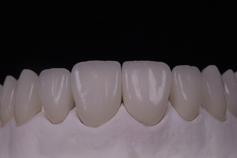 Fig. 13b.