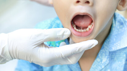 Study highlights barriers to dental care for UAE children with special needs