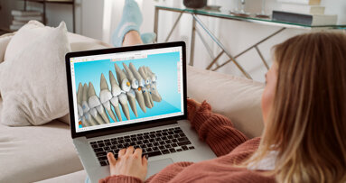 Spark Clear Aligners announces key clinical updates and doctor-driven innovations in Release 14