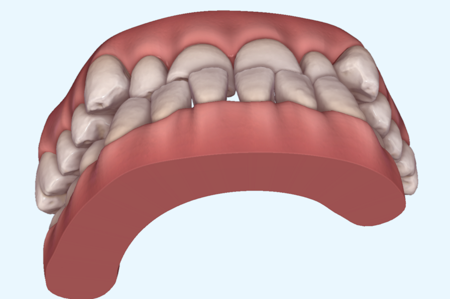 Fig. 18e
