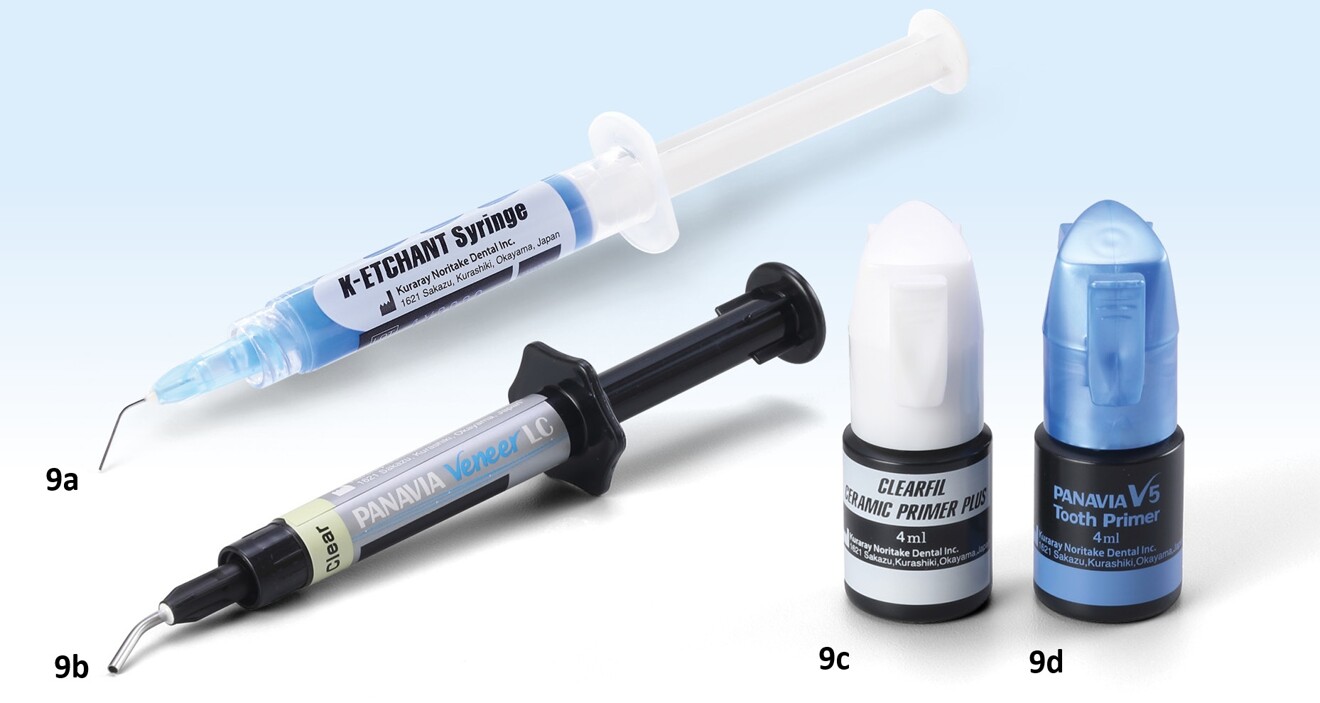Figs. 9a–d: Cementation system: phosphoric acid etchant (a), resin cement paste (b), ceramic primer (c) and tooth primer (d). 
