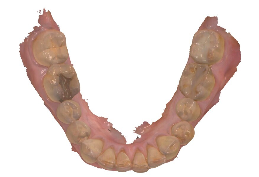 Fig. 3