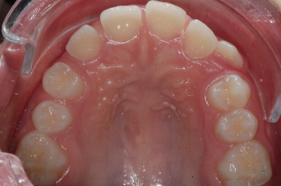 Fig. 10