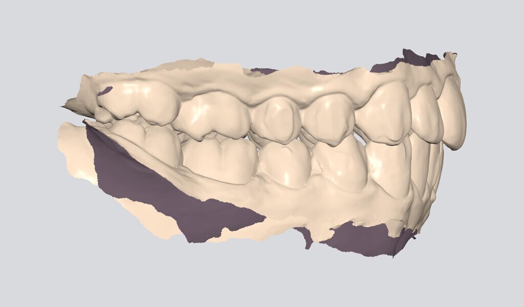 Fig. 20