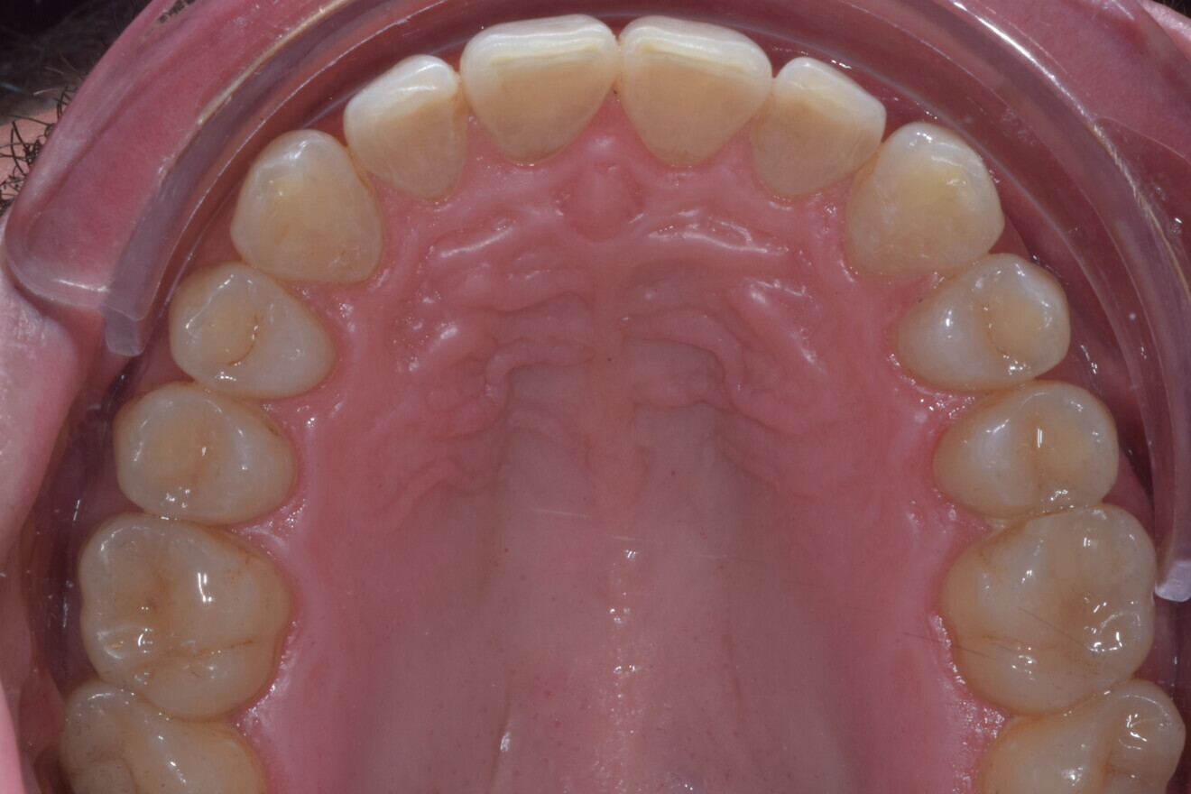 Fig. 23