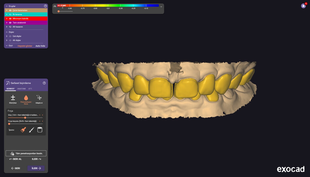 Fig. 2f