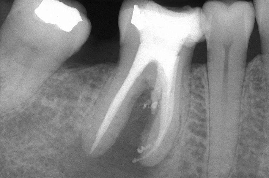Fig. 3h