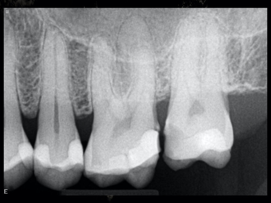 Fig. 9