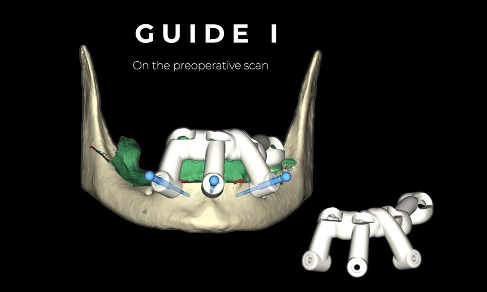 Fig. 22