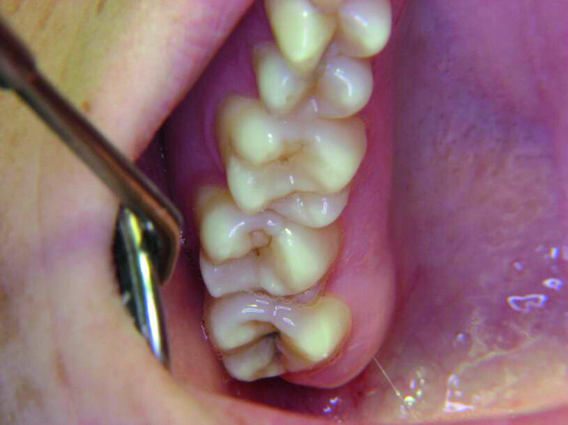 Figure 10b