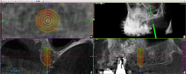 Fig. 11