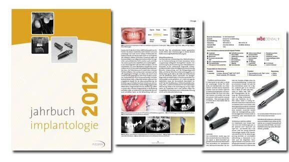 Neuerscheinung: Jahrbuch Implantologie 2012