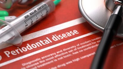 Knowledge about risk factors associated with periodontal disease among patients referred to a specialist periodontal clinic