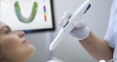 Nine questions and answers about 3Shape’s ultimate TRIOS intra-oral scanner