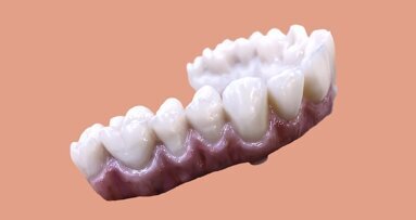 Nobel Biocare and DOCERAM Medical Ceramics expand partnership