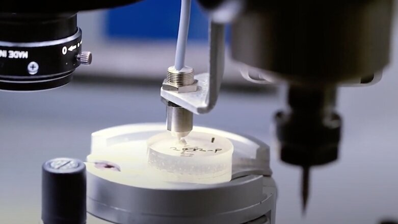 Scientists identify biomarkers for neurological disease in teeth