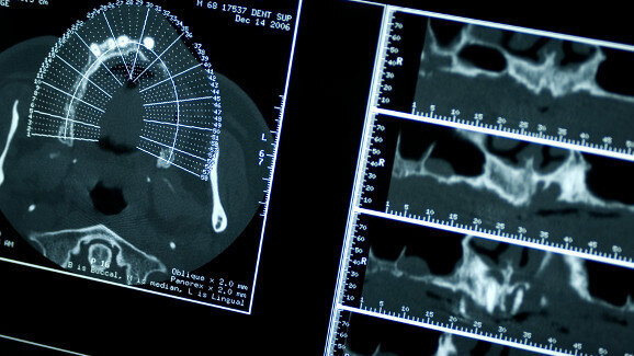 Patientenumfrage: Höhere Beiträge für moderne Medizintechnik akzeptabel