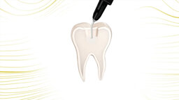COLTENE – BRILLIANT Bulk Fill Flow - Aesthetic and durable restorations saving time and money