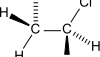 נזקים אסתטיים בטיפולים דנטליים