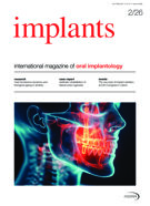 implants international No. 2, 2026