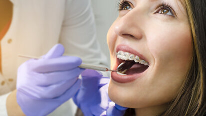 Survey shows number of UK adults seeking orthodontic treatment remains high