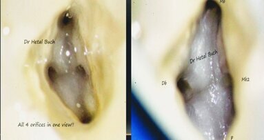 10 essential aspects for implementing magnification in your practice