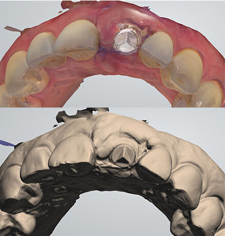 Fig. 25