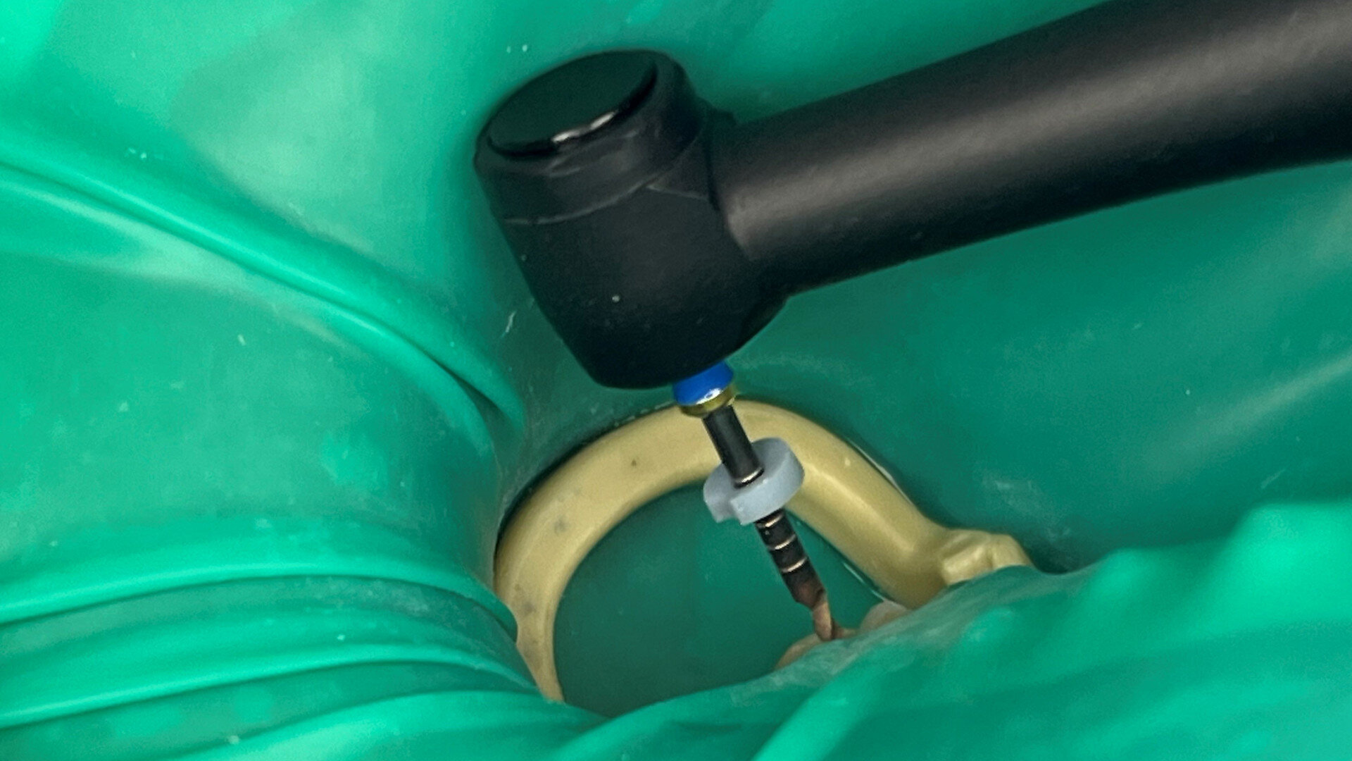 Practical tips for reliable endodontic treatment