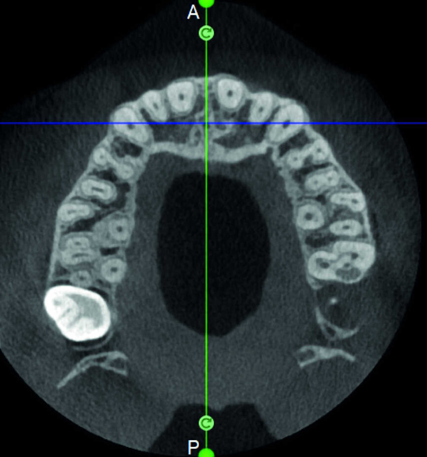 Figure 14