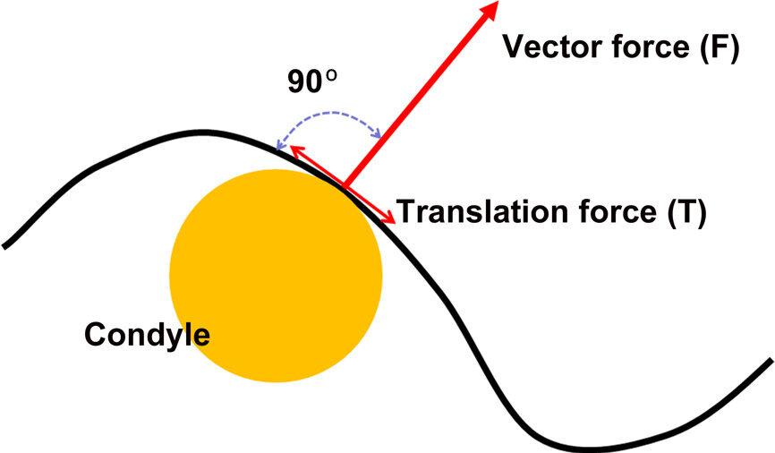 Fig. 9: The condyle position is based on the vector of force of the elevator muscles—perpendicular to the contour of the eminence.