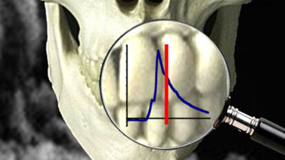 Putting teeth into forensic science