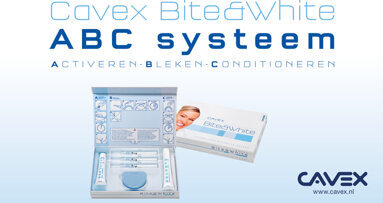 Veilig en snel witte tanden met de Bite&White ABC Masterkit