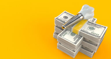Le marché des implants dentaires devrait atteindre 5,9 milliards de dollars d’ici 2028