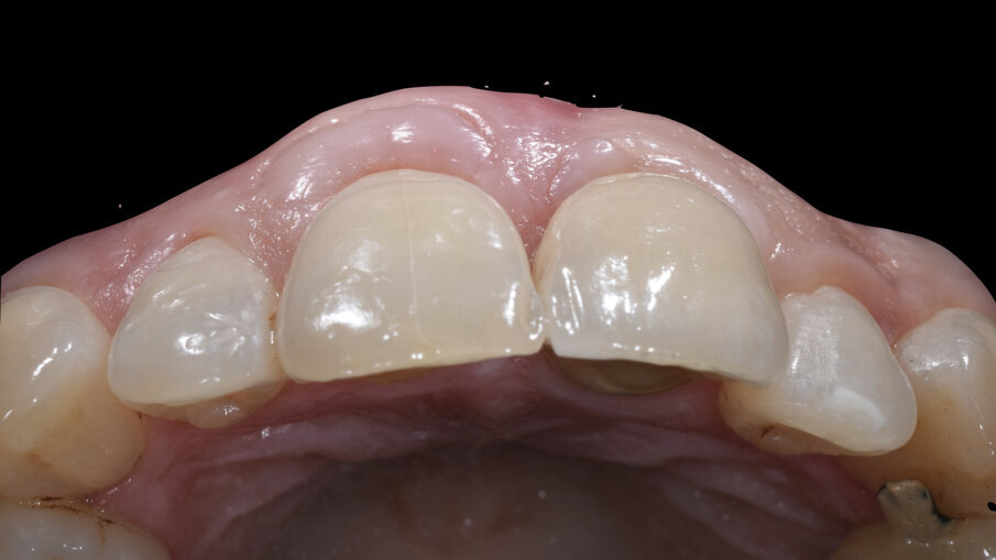 Fig. 22