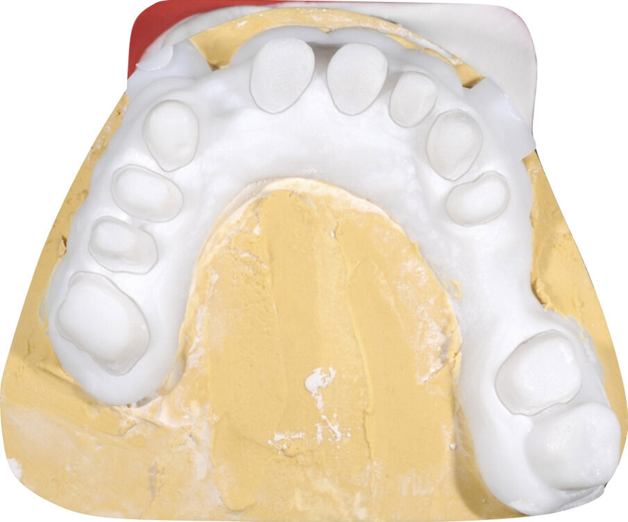 Fig. 19