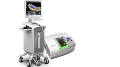 Clinical evaluation and laboratory comparison of chairside CAD/CAM systems