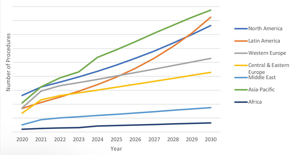 Evolution of immediate loading procedure volume globally between 2020 and 2030 (Source: iData Research).