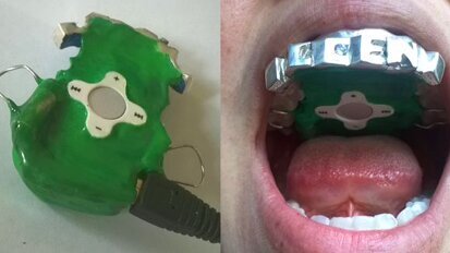 Design student develops first dental MP3 player