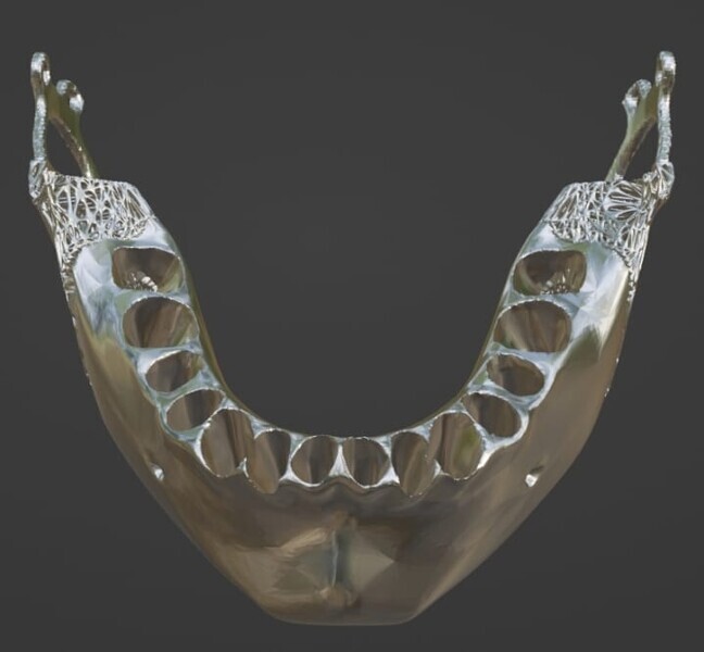 Fig 1i