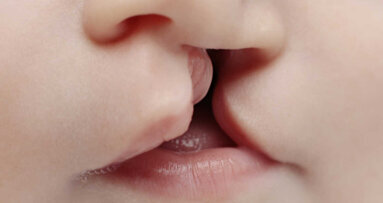 New explanation for the genetic mechanism that triggers cleft lip and palate