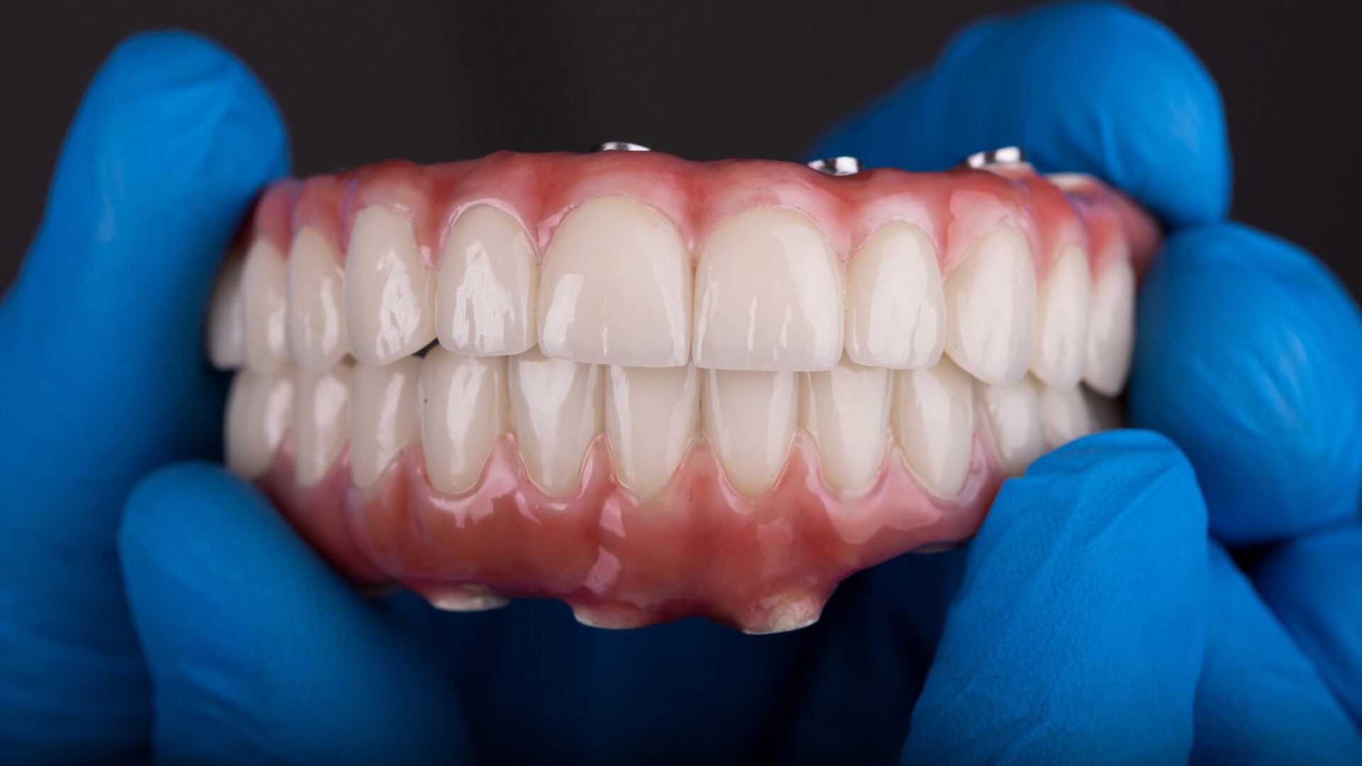 An interview with Dr Adam Nulty on all-on-X dentistry
