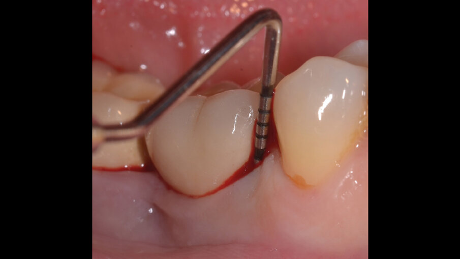 Fig. 1c